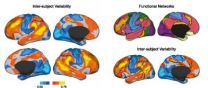 Brain research provides clues to what makes people think and behave differently