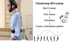 Brain stimulation improves walking in patients with Parkinson’s disease