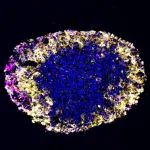 Brain tumor organoids accurately model patient response to CAR T cell therapy