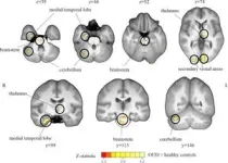 Brain volume changes seen in opioid users 3