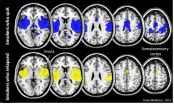 Brains of smokers who quit successfully might be wired for success