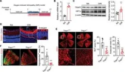 Breakthrough technology offers promising treatment for ischemic retinopathy 2