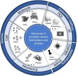 Breakthroughs in prostate cancer: New insights into biomarkers and probes