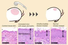 Bubbly idea: Ultrafine bubble showers suppress atopic dermatitis