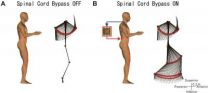 Bypass commands from the brain to legs through a computer 3