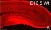 Cajal-Retzius cell loss and amyloidosis in Alzheimers disease