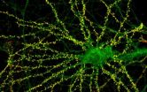 Caltech scientists point to link between missing synapse protein and abnormal behaviors