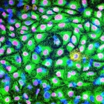 Camouflaging stem cell-derived transplants avoids immune rejection