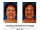 Can facial plastic surgery make you more likeable? 2