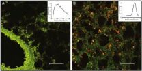 Cancer drug linked to quantum dots increases drug uptake, reduces inflammation