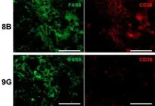 Cancer stem cells trigger macrophage aging 3