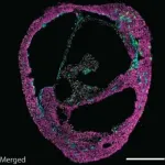 Cardioids -- heartbeat, heartbreak and recovery in a dish