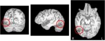 Carnegie Mellon and Princeton neuroscientists uncover neural mechanisms of object recognition