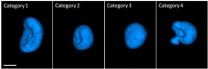 Cell-CT: A new dimension in breast cancer research