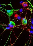 Cell’s ‘garbage disposal’ may have another role: helping neurons near skin sense the environment