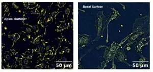 Cell study suggests pesticide exposure may increase COVID-19 susceptibility