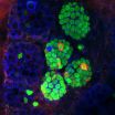 Cellular alchemy: Penn study shows how to make insulin-producing cells from gut cells