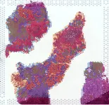 Cellular ‘atlas’ of prostate cancer opens new avenues for earlier detection 2