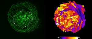 Cellular mechanisms of early mammary gland development unraveled