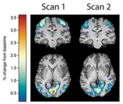 Center for BrainHealth publishes new model to predict improvement in brain health