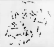 Charité study in Nature: How cells deal with extra chromosomes