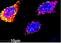 Chemotherapy-resistant ovarian cancer cells protect their neighbors 2