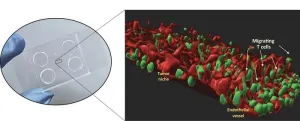 Cholangiocarcinoma: New organ-on-chip aims at accelerating research and personalized medicine