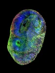 CHOOSEn fate: one brain organoid’s tale on Autism