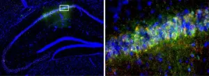 Circadian clock gene helps mice form memories better during the day