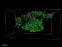 City of Hope and Mount Sinai scientists first to demonstrate a combination treatment can increase human insulin-producing cells in vivo 2