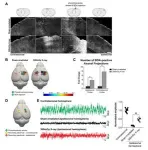 CityU neuroscientists uncover the therapeutic potential of low-dose ionizing radiation for traumatic brain injury and ischemic stroke 2