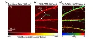 CityU researchers develop ultra-sensitive photoacoustic microscopy for wide biomedical application potential 2