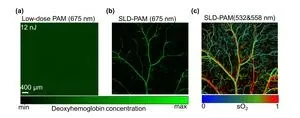 CityU researchers develop ultra-sensitive photoacoustic microscopy for wide biomedical application potential 3