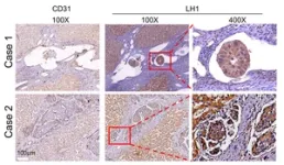 CityU researchers identify a protein that promotes cancer metastasis, providing a new potential treatment target 2