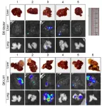 CityU researchers identify a protein that promotes cancer metastasis, providing a new potential treatment target 3