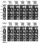 Clear holographic imaging in turbulent environments 2