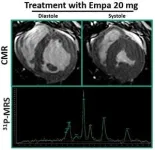 CNIC scientists design an effective treatment strategy to prevent heart injury caused by a class of anticancer drugs 2