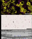 CNIC scientists discover a key mechanism in fat cells that protects the body against energetic excess