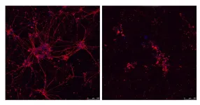 CNIO researchers discover the cause of neuronal death in a large proportion of familial ALS patients