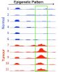 Colon cancer exhibits a corresponding epigenetic pattern in mice and humans