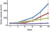 Combination therapy may help patients with follicular lymphoma