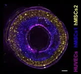 Combining bioprinting techniques to pursue functional blood vessels 2