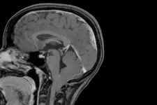 Common brain malformation traced to its genetic roots