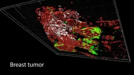 Complexity of tumors revealed in 3D