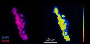 Comprehensive atlas of normal breast cells offers new tool for understanding breast cancer origin 2