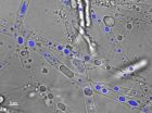 Contaminant transport in the fungal pipeline