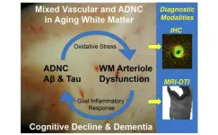 Contributions to white matter injury in Alzheimer’s disease