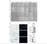 Cover paper: Senescent characteristics of human corneal endothelial cells upon UV-A exposure