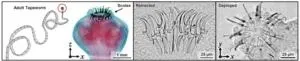 COVID infection and age-related blindness 2