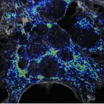 Cracking the case of mitochondrial repair and replacement in metabolic stress